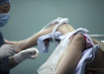 呼和浩特做人流