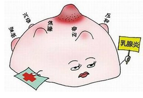 治疗乳腺炎多少钱