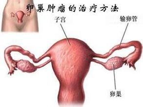 怎样检查卵巢肿瘤