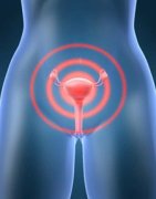 治疗阴道炎需要多长时间