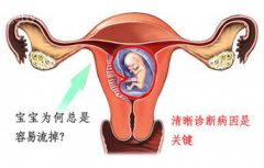 习惯性流产原因