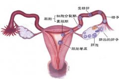 治疗排卵障碍的方法有哪些