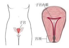 子宫出血是什么原因