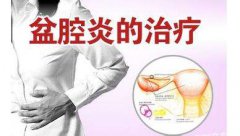 <b>什么原因导致女性患上盆腔炎</b>